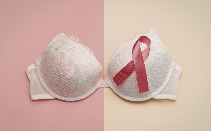 Entenda o que as calcificações vasculares no laudo da mamografia podem indicar sobre a saúde cardiovascular com a análise de Vinicius Tadeu Sattin Rodrigues na condução da avaliação clínica.