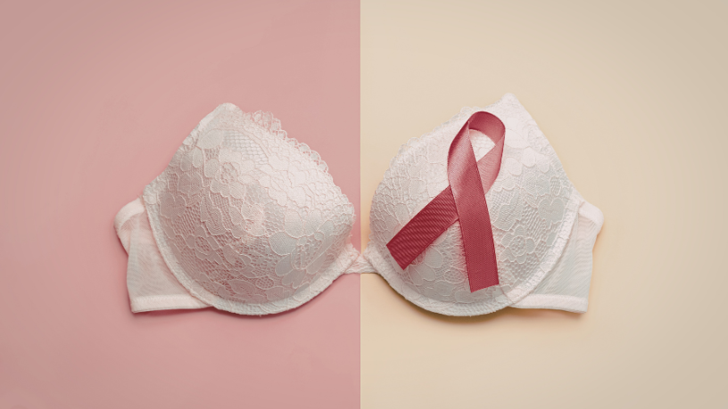 Entenda o que as calcificações vasculares no laudo da mamografia podem indicar sobre a saúde cardiovascular com a análise de Vinicius Tadeu Sattin Rodrigues na condução da avaliação clínica.